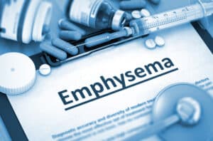 Senior Care in Anderson SC: FAQs About Emphysema in the Elderly