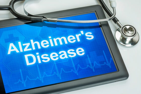 What Is The Earliest Symptom Of Alzheimer